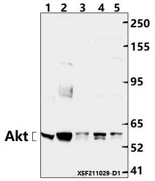 Western blot (WB) analysis of Akt (A444) polyclonal antibody at 1:1000 dilution
Lane1:PMVEC whole cell lysate(40ug)
Lane2:BV2 whole cell lysate(40ug
Lane3:EC9706 whole cell lysate(40ug)
Lane4:MCF-7 whole cell lysate(40ug)
Lane5:HepG2 whole cell lysate(40ug)