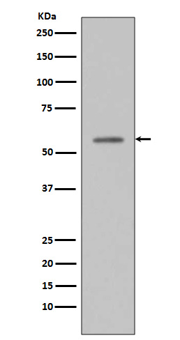 Phospho p53 (Ser33) Rabbit Monoclonal Antibody [Clone ID: OTIRA0054]