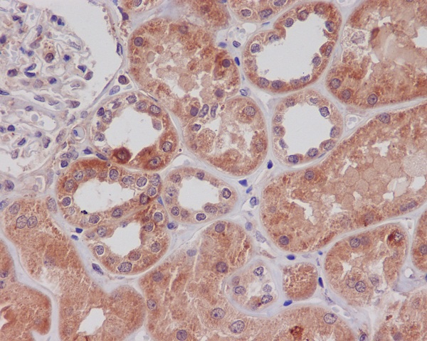 Immunohistochemical analysis of paraffin-embedded human kidney, using TLR2 Antibody.