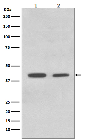 ACADM Rabbit Monoclonal Antibody [Clone ID: OTIRA0178] | TA422359 ...