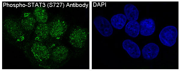 Phospho STAT3 (Ser727) Rabbit Monoclonal Antibody [Clone ID: OTIRA0181]