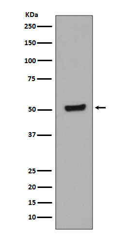 Phospho p53 (Thr55) Rabbit Monoclonal Antibody [Clone ID: OTIRA0316]
