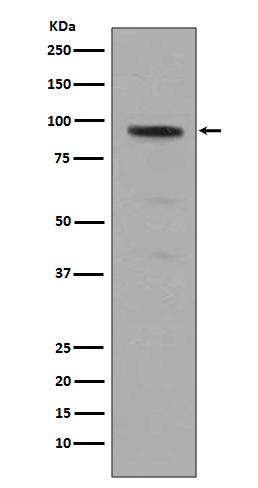 Phospho Stat5 (Tyr694) Rabbit Monoclonal Antibody [Clone ID: OTIRA0370]