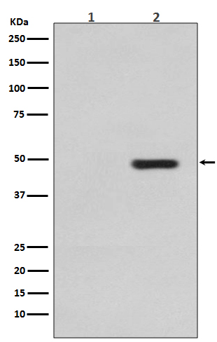 Phospho Tau (Thr231) Rabbit Monoclonal Antibody [Clone ID: OTIRA0405]