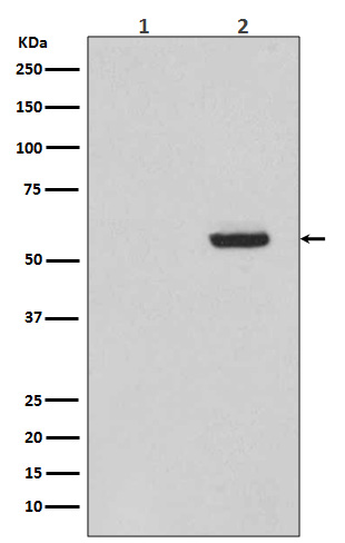 Phospho Tau (Ser396) Rabbit Monoclonal Antibody [Clone ID: OTIRA0426]