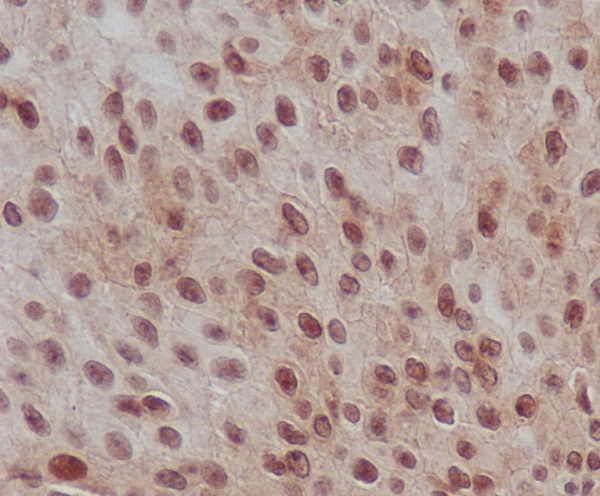 TA422758