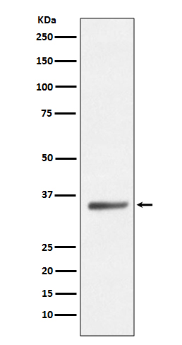 Western blot analysis of SIRT5 expression in HeLa cell lysate.
