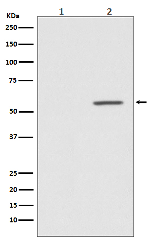 Phospho AKT1 (Ser124) Rabbit Monoclonal Antibody [Clone ID: OTIRA0624]