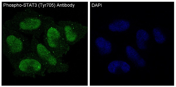 Phospho STAT3 (Tyr705) Rabbit Monoclonal Antibody [Clone ID: OTIRA0680]