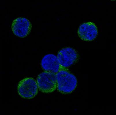 Phospho JAK2 (Tyr1007/1008) Rabbit Monoclonal Antibody [Clone ID: OTIRA0681]