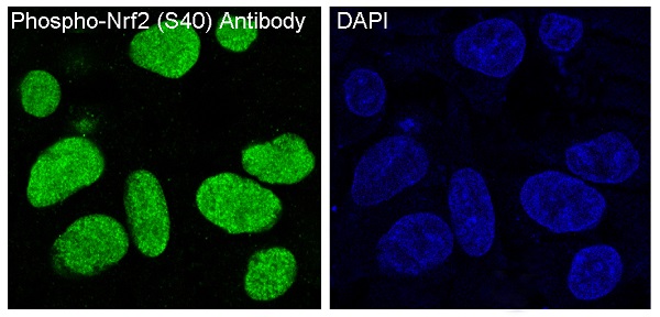 Phospho Nrf2 (Ser40) Rabbit Monoclonal Antibody [Clone ID: OTIRA0683]