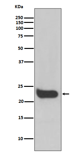 Interferon beta (IFNB1) Rabbit Monoclonal Antibody [Clone ID: OTIRA0771 ...