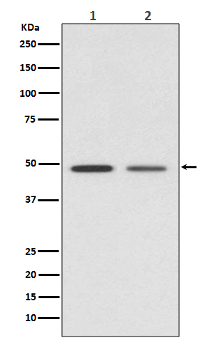 Western blot analysis of Vitamin D expression in (1) HeLa cell lysate; (2) Mouse kidney lysate.