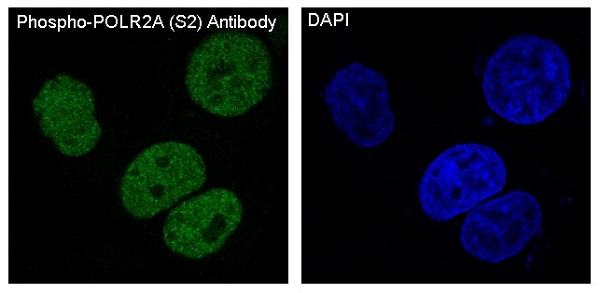 Phospho POLR2A (Ser2) Rabbit Monoclonal Antibody [Clone ID: OTIRA0890]