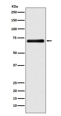 Western blot analysis of EAAT2 expression in HeLa cell lysate.
