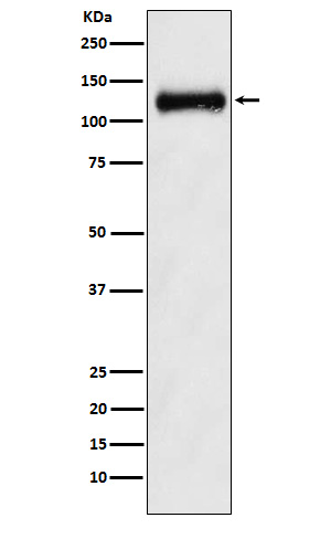 Western blot analysis of ANPRB expression in Human fetal kidney lysate.