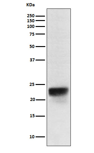 FSH beta (FSHB) Rabbit Monoclonal Antibody [Clone ID: OTIRA1794 ...