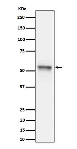 Phospho Tau (Ser199) Rabbit Monoclonal Antibody [Clone ID: OTIRA1911]