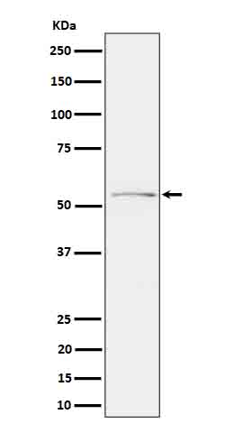 Phospho Tau (Ser214) Rabbit Monoclonal Antibody [Clone ID: OTIRA1912]
