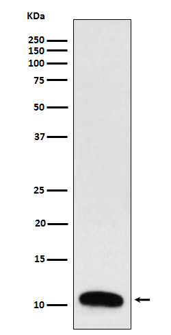 Western blot analysis of Trefoil Factor 3 expression in Human colon cancer lysate.