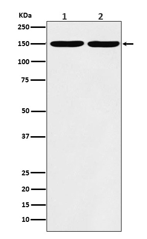 Collagen III (COL3A1) Rabbit Monoclonal Antibody [Clone ID: OTIRA2104 ...