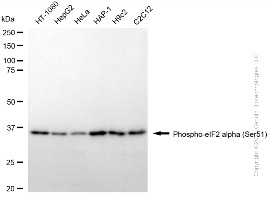 EIF2S1 Rabbit Monoclonal Antibody [Clone ID: 24GB3905]