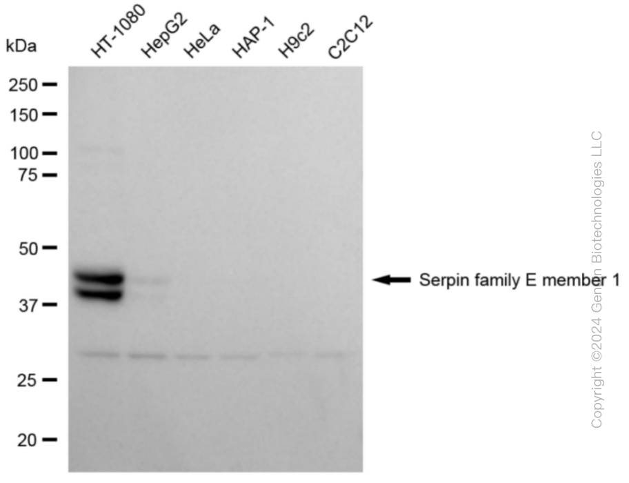 SERPINE1 Rabbit Monoclonal Antibody [Clone ID: 24GB4055]