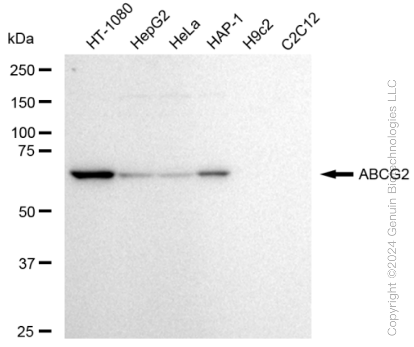 ABCG2 Rabbit Monoclonal Antibody [Clone ID: 23GB3130]