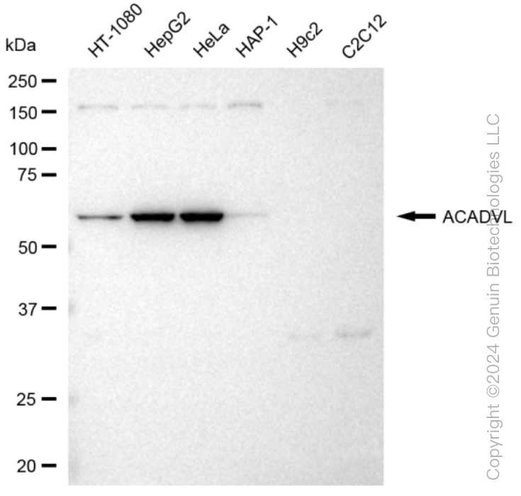 ACADVL Rabbit Monoclonal Antibody [Clone ID: 23GB3615]