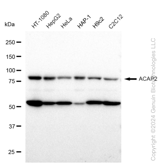 ACAP2 Rabbit Monoclonal Antibody [Clone ID: 23GB1565]