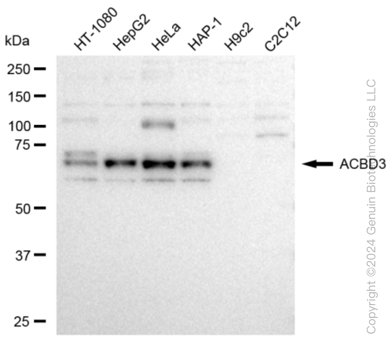 ACBD3 Rabbit Monoclonal Antibody [Clone ID: 23GB3620]
