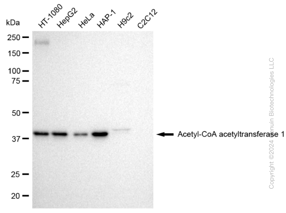 ACAT1 Rabbit Monoclonal Antibody [Clone ID: 23GB1255]