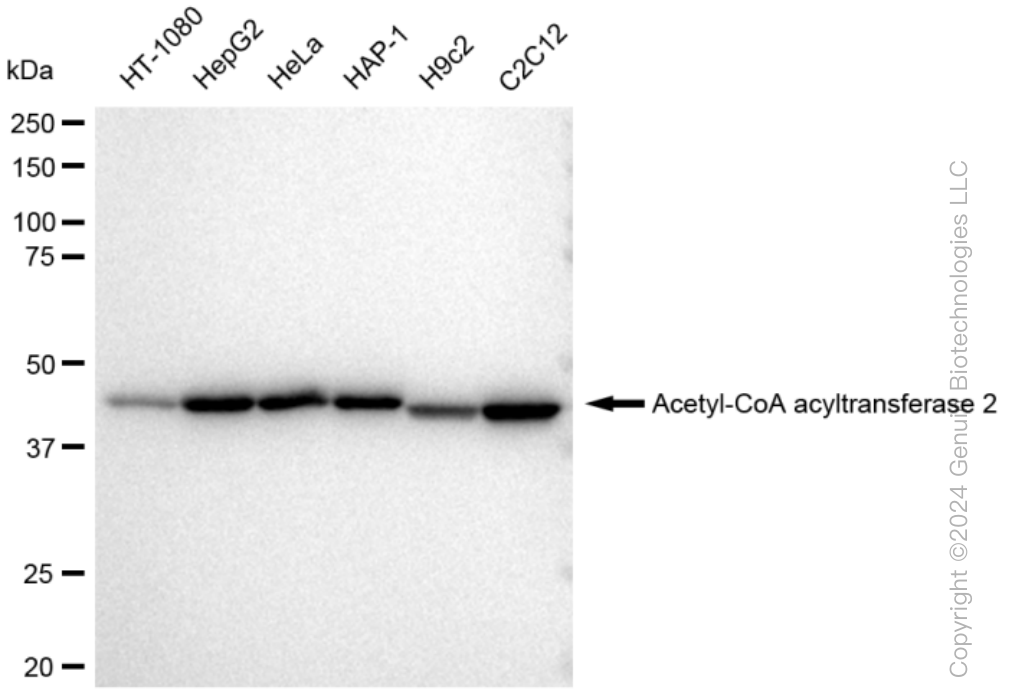 ACAA2 Rabbit Monoclonal Antibody [Clone ID: 23GB2955]