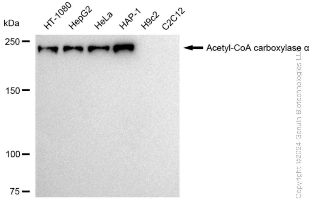 ACACA Rabbit Monoclonal Antibody [Clone ID: 23GB5645]