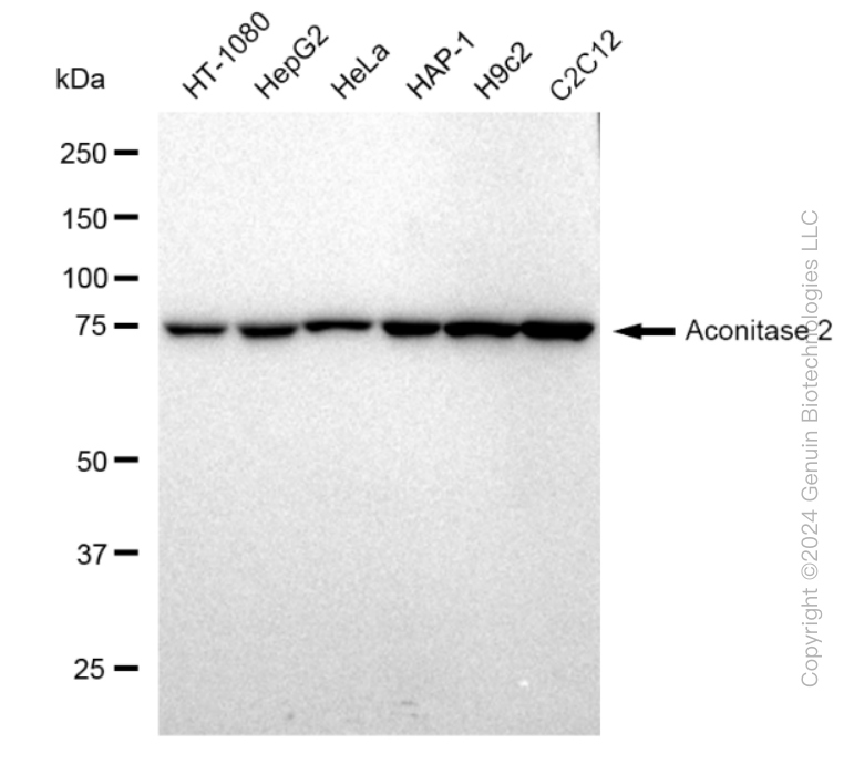 ACO2 Rabbit Monoclonal Antibody [Clone ID: 23GB1585]