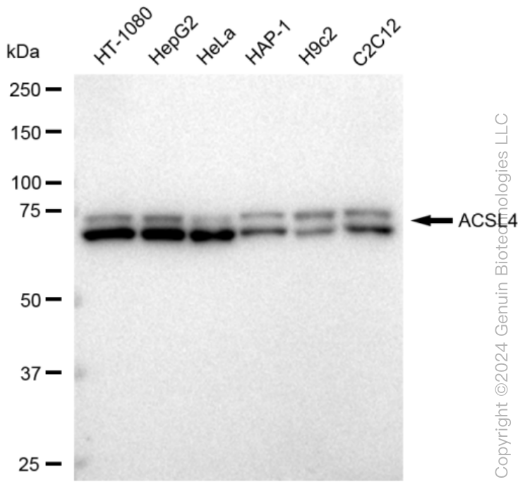 ACSL4 Rabbit Monoclonal Antibody [Clone ID: 23GB2960]