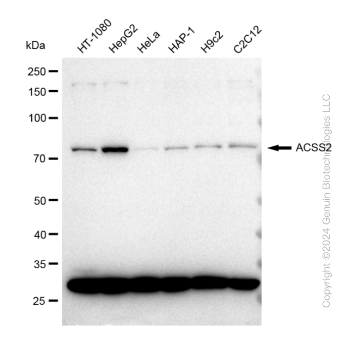 Western blotting analysis using anti-ACSS2 antibody . Total cell lysates (45 μg) from various cell lines were loaded and separated by SDS-PAGE. The blot was incubated with anti-ACSS2 antibody and HRP-conjugated goat anti-rabbit secondary antibody respectively. Image was developed using anti-FeQ™ ECL Substrate Kit . ACSS2, acyl-CoA synthetase short chain family member 2.