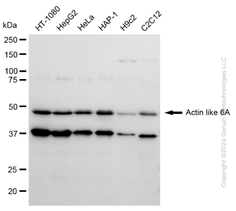 ACTL6A Rabbit Monoclonal Antibody [Clone ID: 23GB1155]
