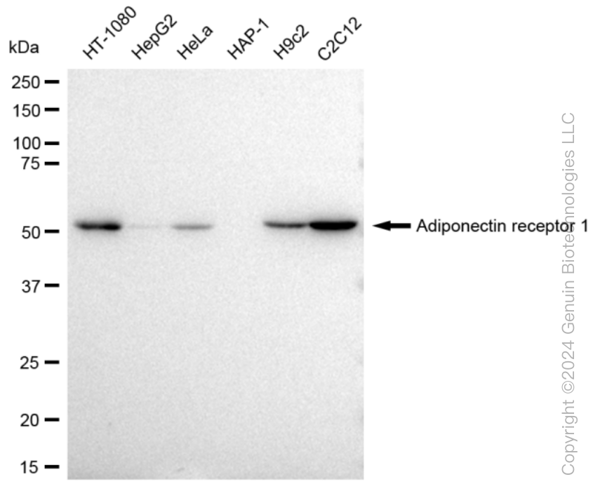 ADIPOR1 Rabbit Monoclonal Antibody [Clone ID: 23GB3150]