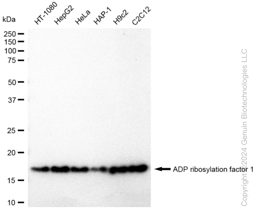 ARF1 Rabbit Monoclonal Antibody [Clone ID: 23GB3155]
