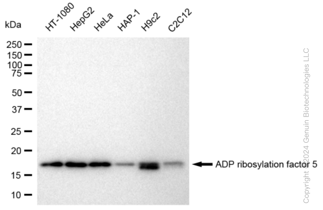 ARF5 Rabbit Monoclonal Antibody [Clone ID: 23GB3635]