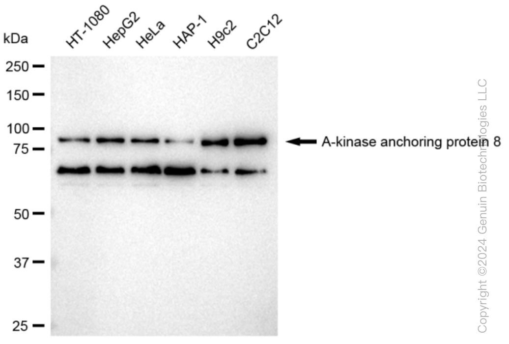 AKAP8 Rabbit Monoclonal Antibody [Clone ID: 23GB2970]