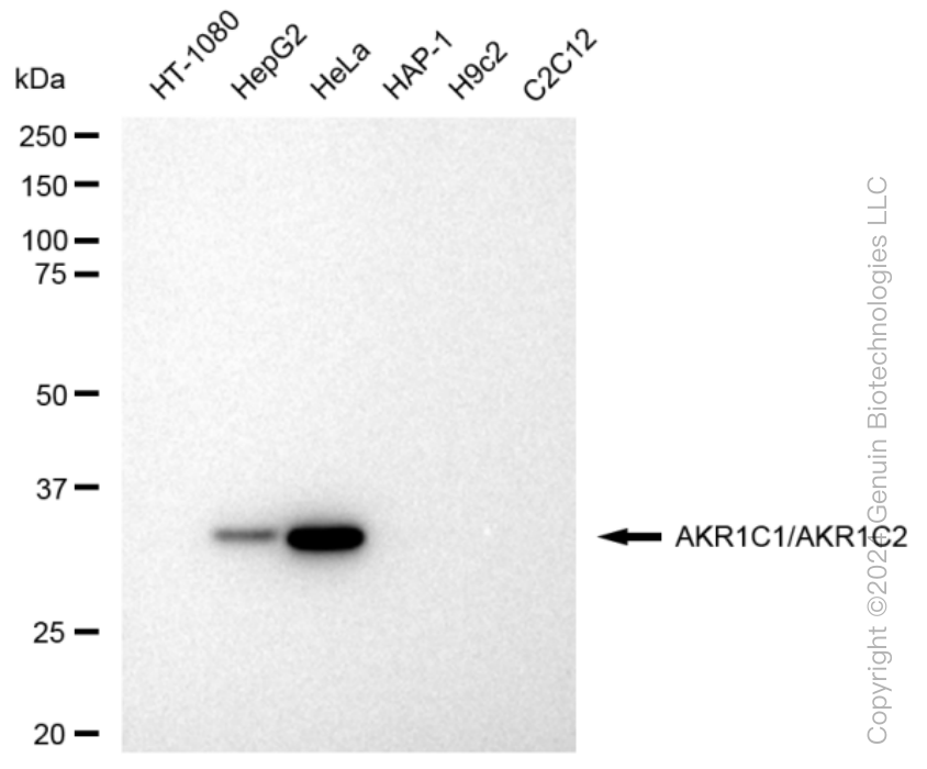 AKR1C1/AKR1C2 Rabbit Monoclonal Antibody [Clone ID: 23GB3175]
