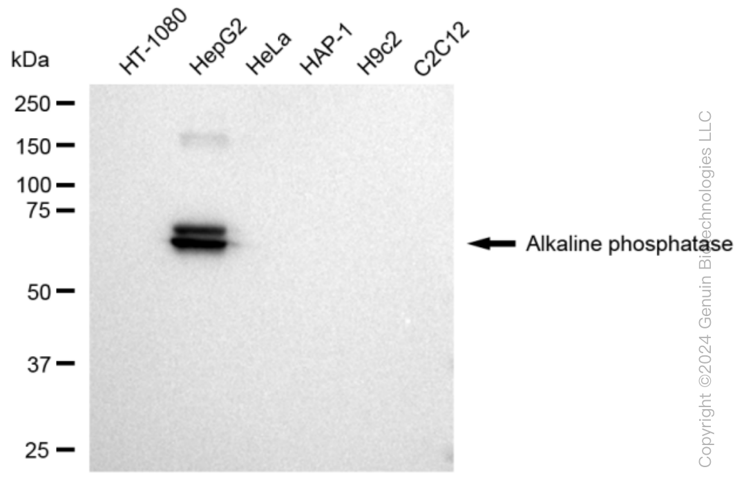 ALPI Rabbit Monoclonal Antibody [Clone ID: 23GB3645]