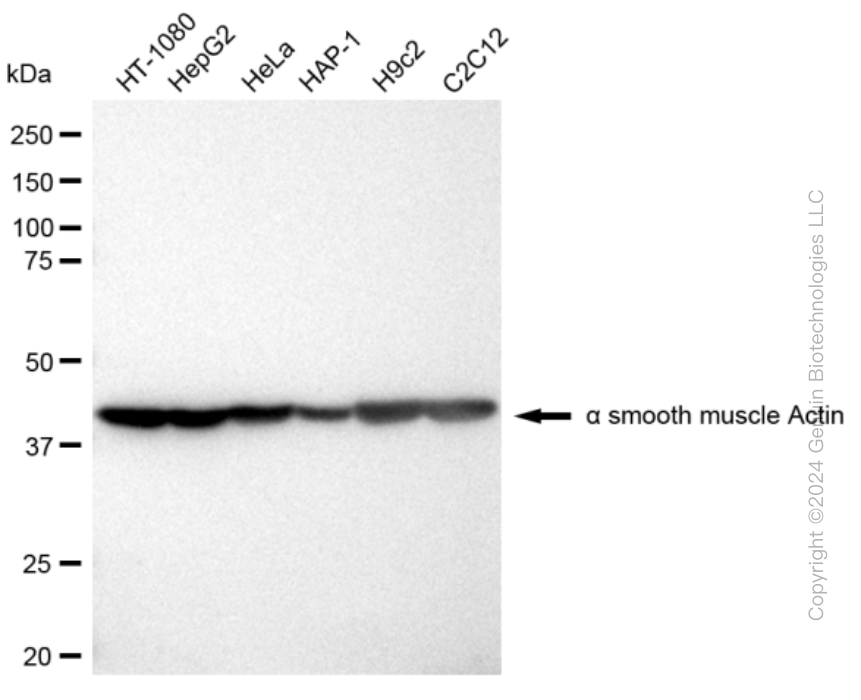 ACTA2 Rabbit Monoclonal Antibody [Clone ID: 23GB605]