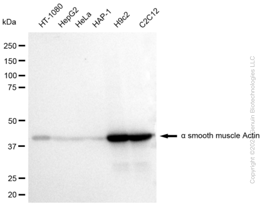 ACTA2 Rabbit Monoclonal Antibody [Clone ID: 23GB600]