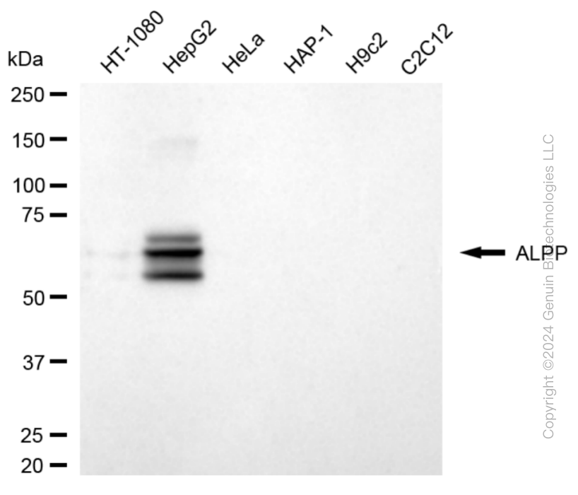 Western blotting analysis using anti-ALPP antibody . Total cell lysates (30 μg) from various cell lines were loaded and separated by SDS-PAGE. The blot was incubated with anti-ALPP antibody and HRP-conjugated goat anti-rabbit secondary antibody respectively. Image was developed using anti-NaQ™ ECL Substrate Kit .