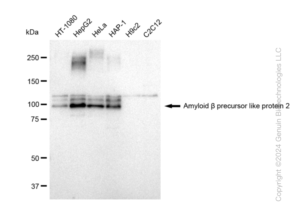 Western blotting analysis using anti-Amyloid beta precursor like protein 2 antibody . Total cell lysates (30 μg) from various cell lines were loaded and separated by SDS-PAGE. The blot was incubated with anti-Amyloid beta precursor like protein 2 antibody and HRP-conjugated goat anti-rabbit secondary antibody respectively. Image was developed using anti-FeQ™ ECL Substrate Kit .