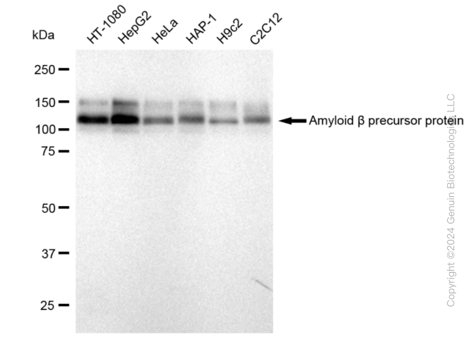 Western blotting analysis using anti-Amyloid beta precursor protein antibody . Total cell lysates (30 μg) from various cell lines were loaded and separated by SDS-PAGE. The blot was incubated with anti-Amyloid beta precursor protein antibody and HRP-conjugated goat anti-rabbit secondary antibody respectively. Image was developed using anti-FeQ™ ECL Substrate Kit .