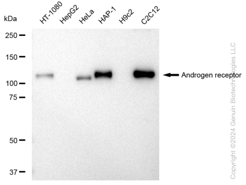 AR Rabbit Monoclonal Antibody [Clone ID: 23GB3210]